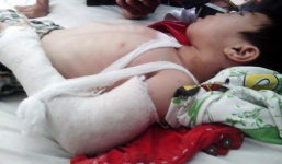 Tâm sự xót xa của người mẹ có con bị nhân tình đánh gãy chân tay